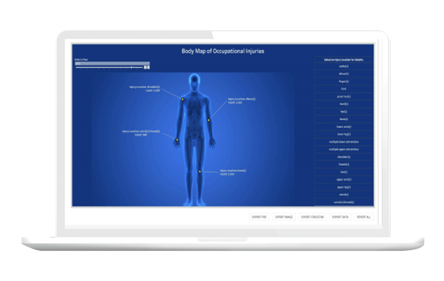 ETQ Insights quality analytics for data quality management with body map